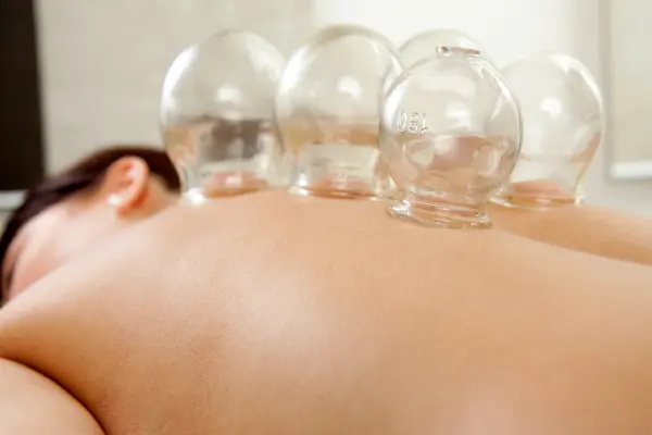 Oil, Cupping Massage